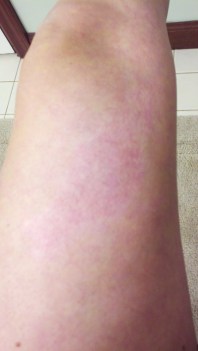 Four and a half months later